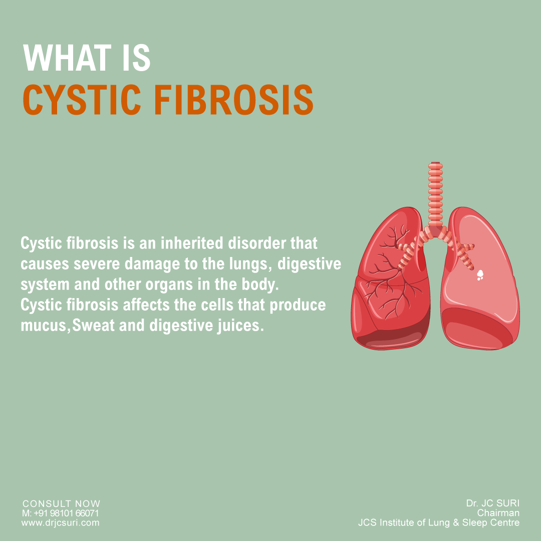 Cystic fibrosis