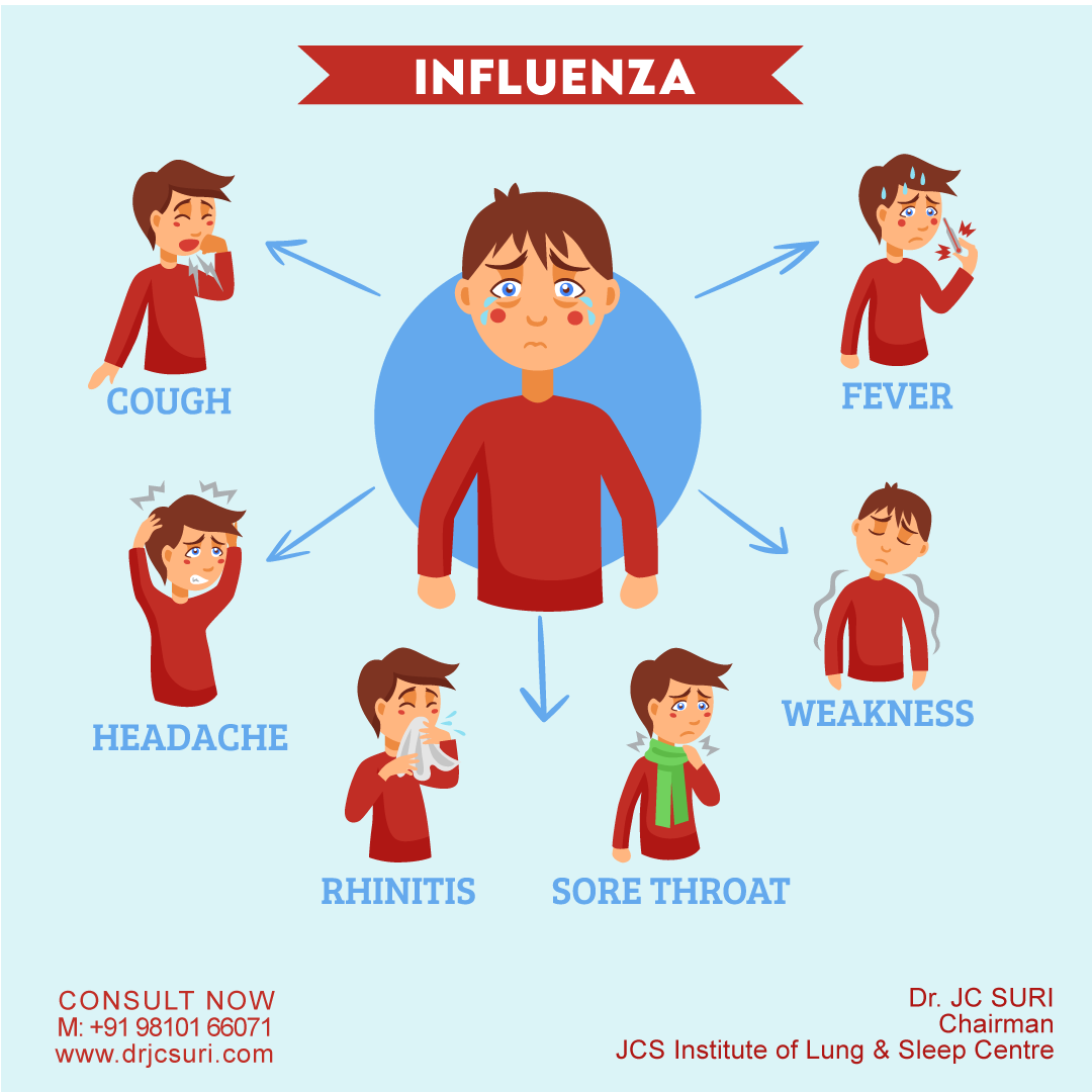 Influenza Insights Symptoms, Causes, and Complications Dr. JC Suri