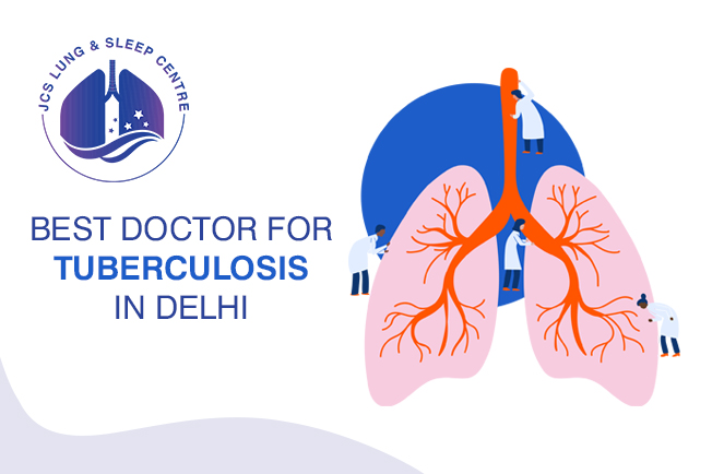 Best Doctor for Tuberculosis in Delhi